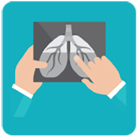 Health effects of vaping on the lungs